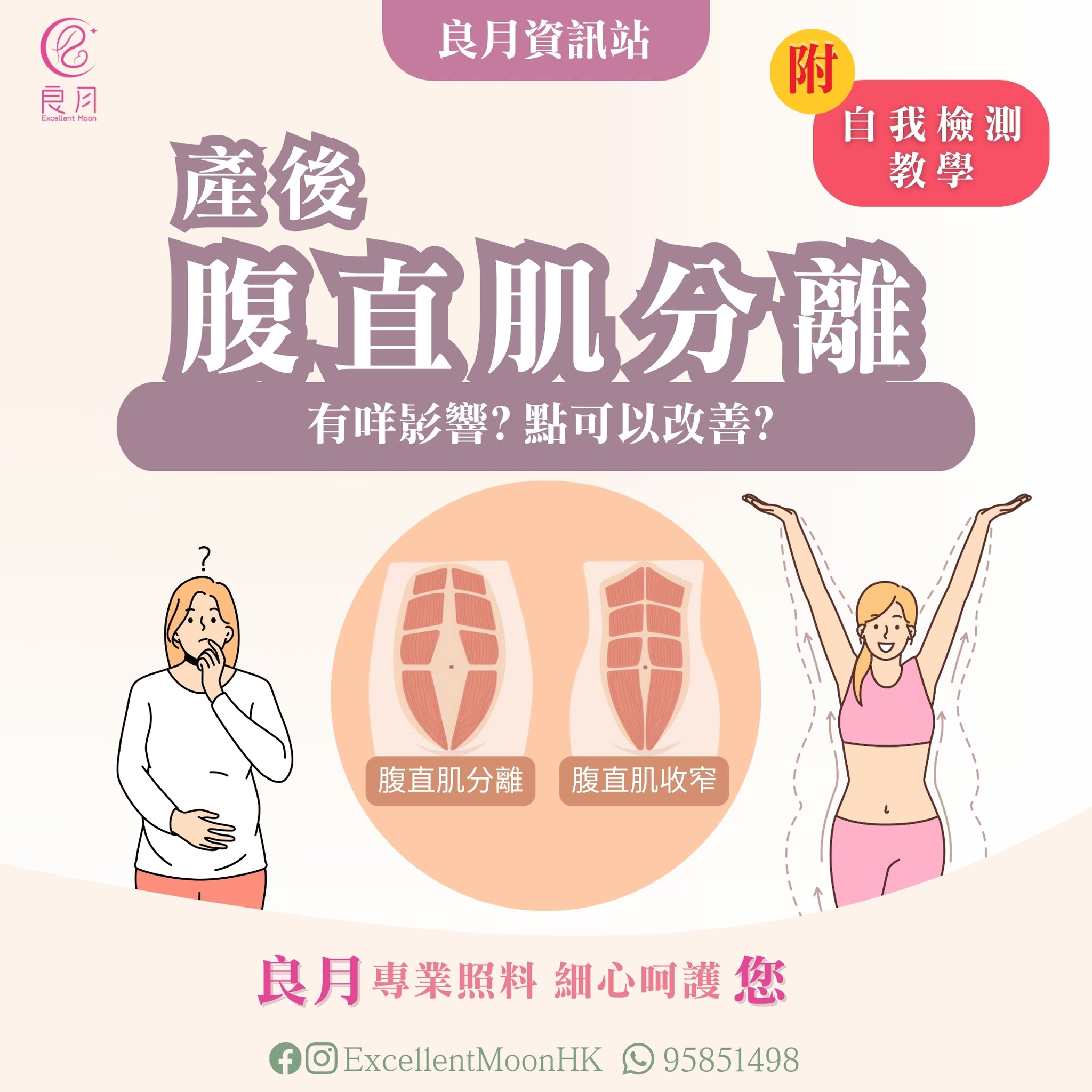產後腹直肌分離 點先算?(附自測教學)- 良月資訊站